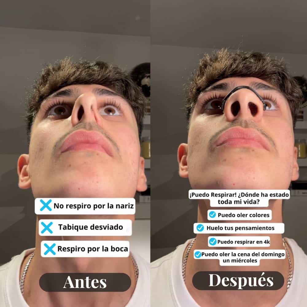 Parche nasal magnectico