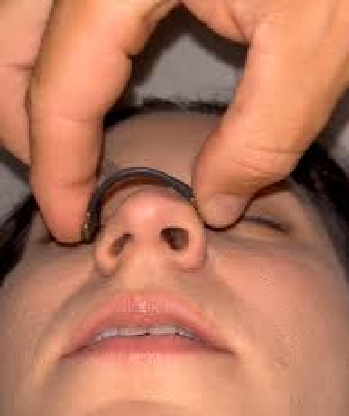 Parche nasal magnectico